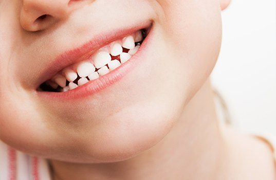 Child's healthy smile after tooth colored filling