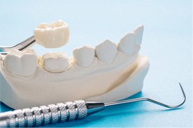 Dental crown and mold of mouth