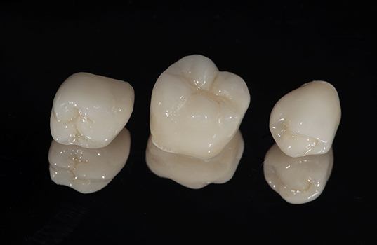 three porcelain dental crowns sitting on a black countertop