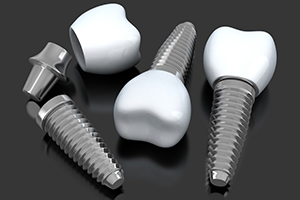Three animated dental implant supported dental crowns