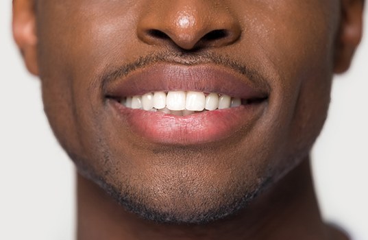 Smiling man with tooth-colored fillings in St. Augustine