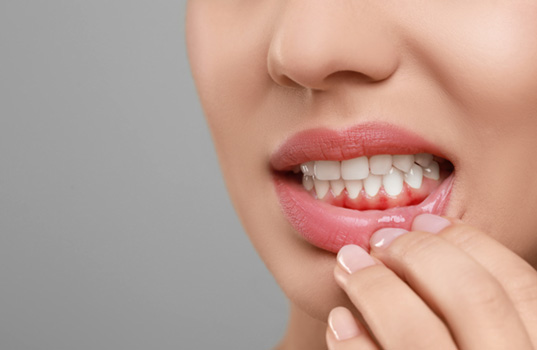 Woman pulling down lip to show red, swollen gums