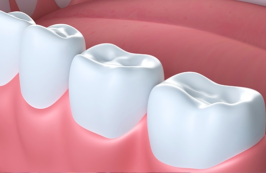 Animated teeth with dental sealants