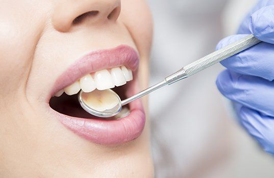 Dentist checking patient's tooth colored filling dental restoration