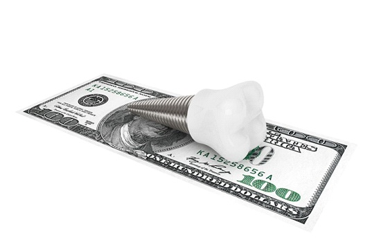 Dental implant in St. Augustine, FL lying on hundred dollar bill