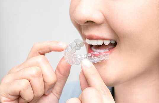 An up-close view of a girl inserting a clear aligner into her mouth