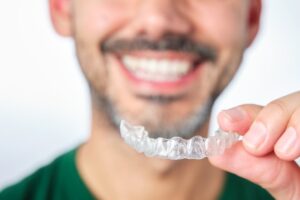 Man smiling after removing his aligners