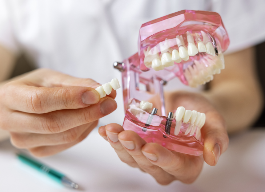 Hands holding plastic dental implant model